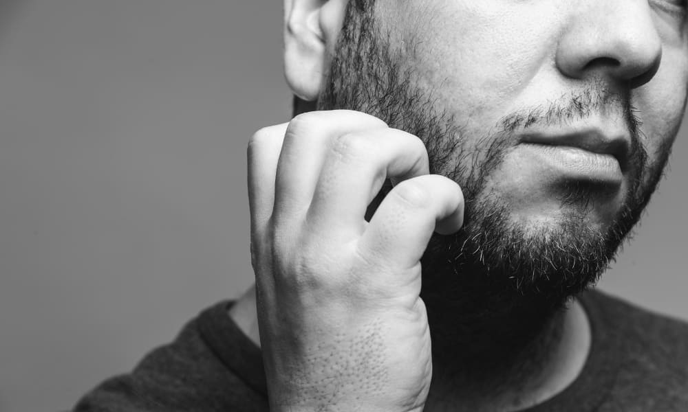 Close-up of a man scratching his itchy beard, showing irritation and uneven beard growth—common beard problems like dryness or dandruff.
