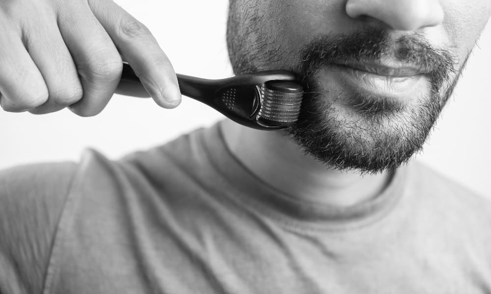 Close-up of a man using a derma roller on his beard, illustrating a popular but overhyped beard growth tool.