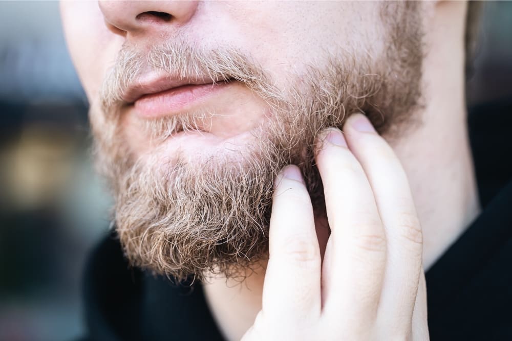 A close-up image of a man with a light brown, patchy beard scratching or inspecting his facial hair. His fingers are gently touching the beard, which appears slightly coarse and uneven. The man's skin shows signs of irritation, possibly caused by ingrown beard hairs. The background is blurred, focusing attention on the man's face and the discomfort associated with ingrown beard hairs. This highlights issues related to beard care and grooming routines.