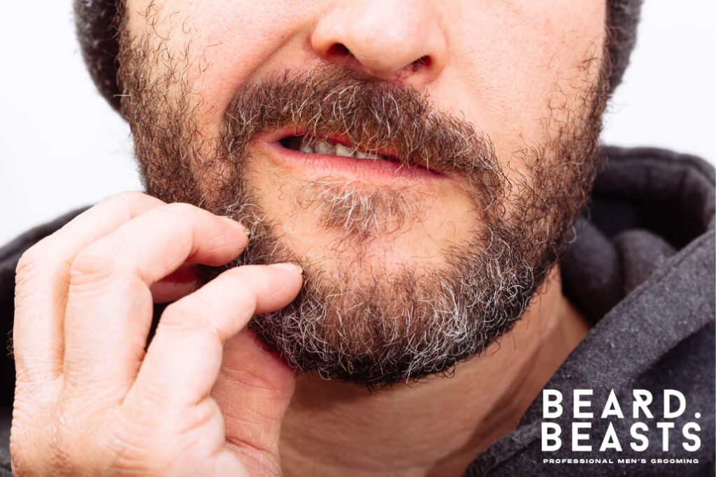 Close-up of a man scratching his beard, showing visible irritation, likely due to beard acne, with the Beard Beasts logo in the corner.