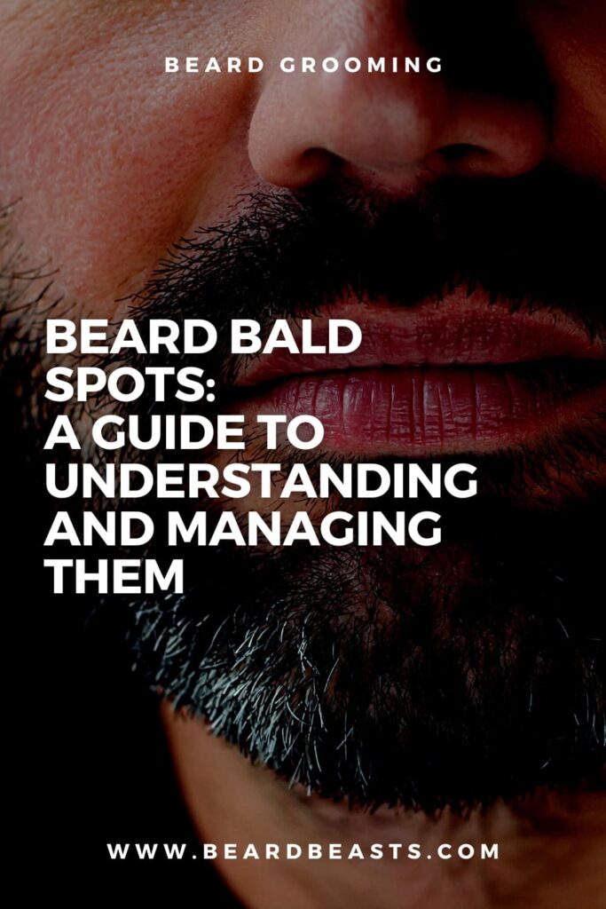 Beard Bald Spots: A Guide to Understanding and Managing Them Pinterest Pin
