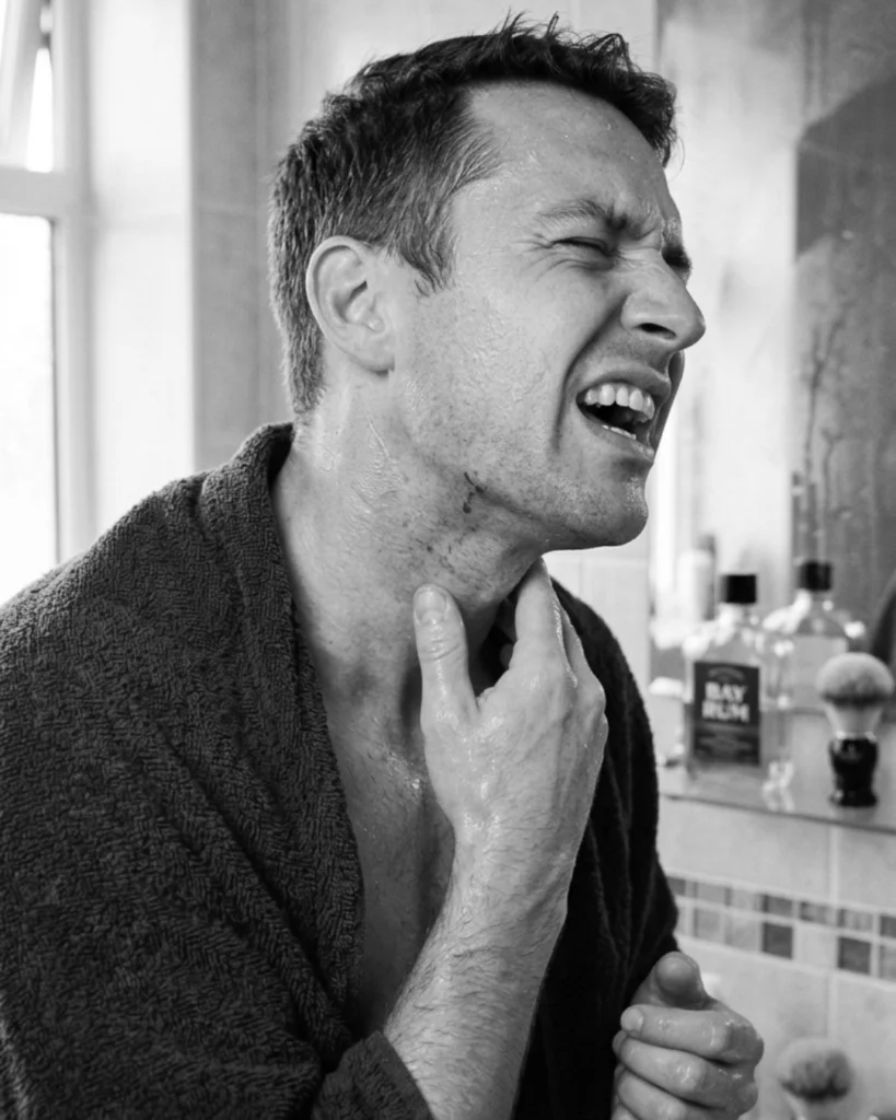 Man reacting to burning aftershave on a freshly shaved neck with visible redness and irritation