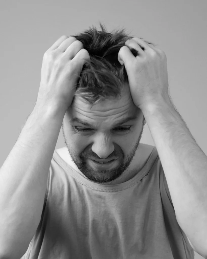 Man frustrated by dry, greasy, or flaky hair and scalp problems