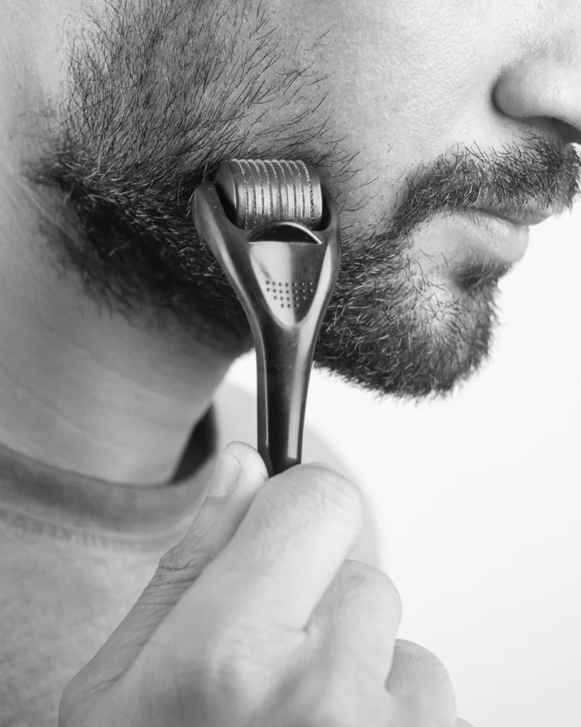 Man using a derma roller on his beard, showing why minoxidil and derma rolling for beard growth need a proper answer instead of casual grooming advice.