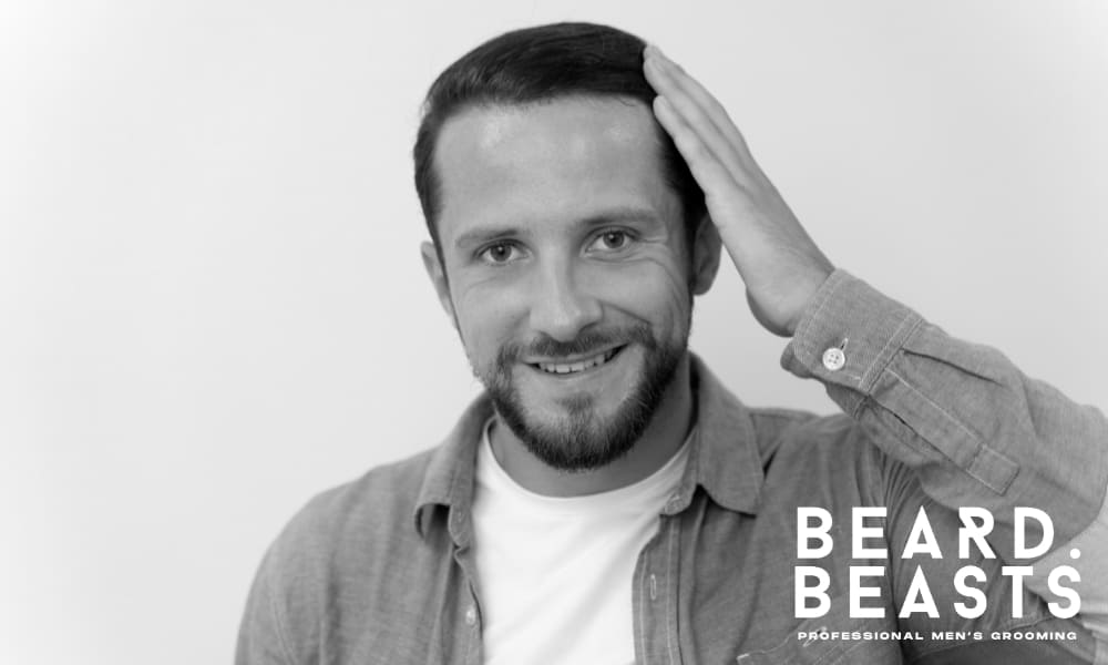 Black and white image of a smiling man with a short, flat hairstyle, demonstrating a lack of volume in his hair. His hair lies close to the scalp, showing the need for volume-boosting techniques.