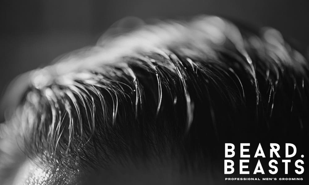 Close-up of oily hair in men, showing excess sebum and greasy hair texture.