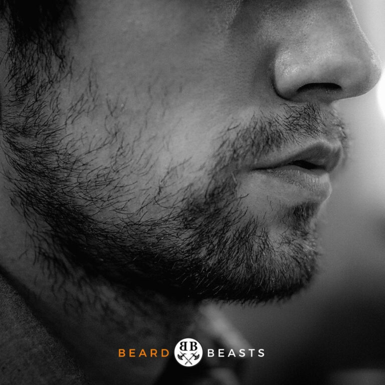 Beard Bald Spots - Beard Beasts