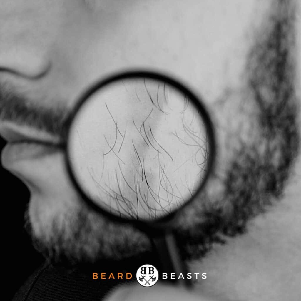 Beard Hair Loss: Causes