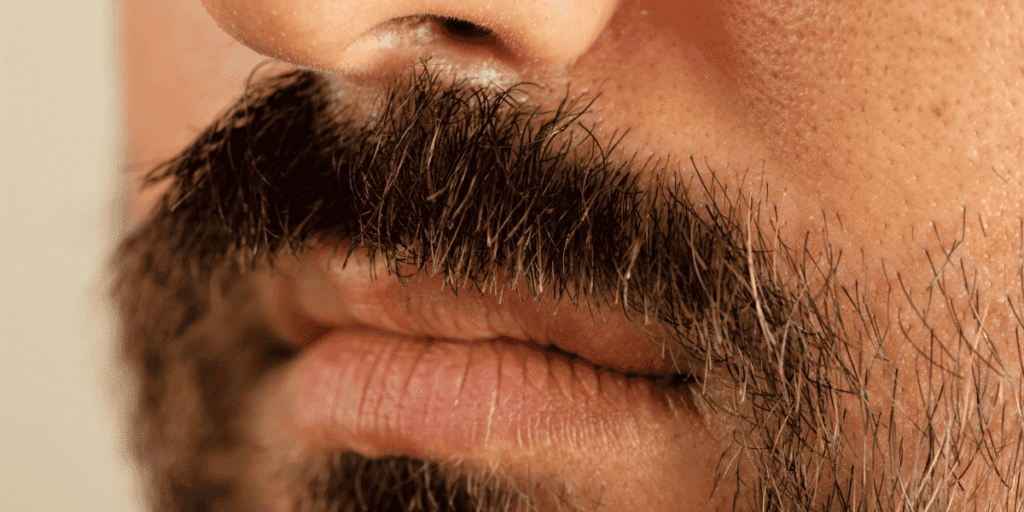 Dry Beard: Causes