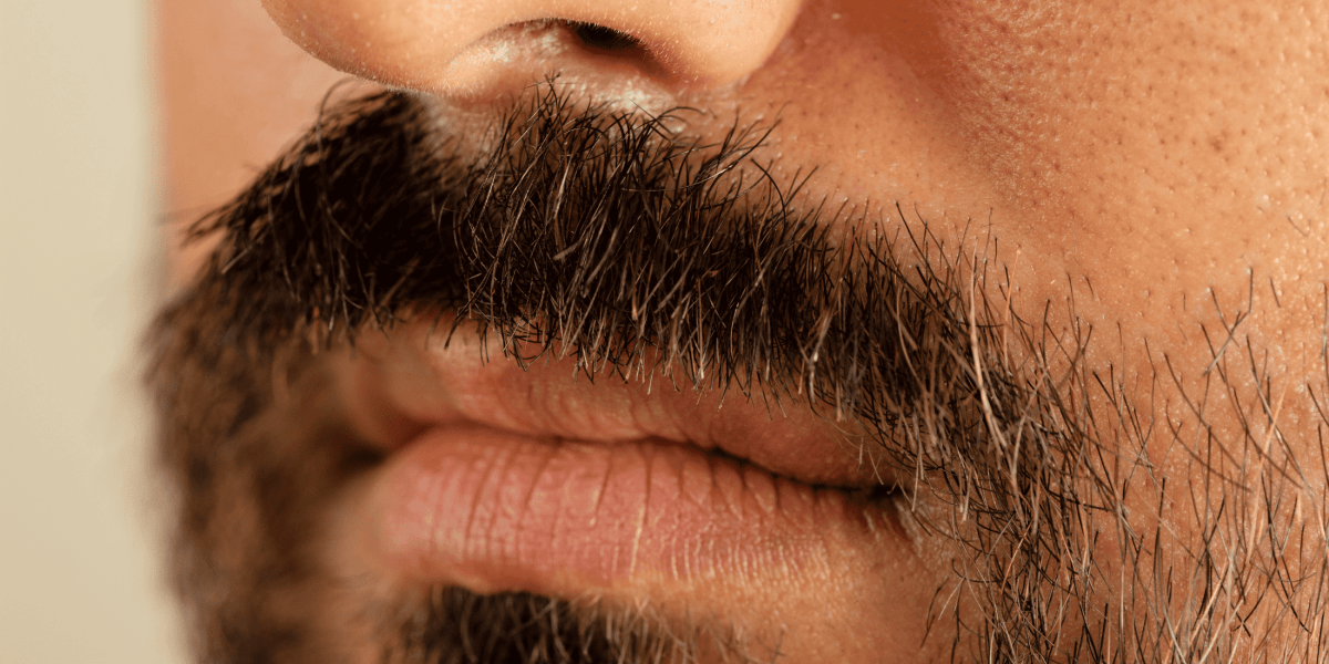 Dry Beard: Causes