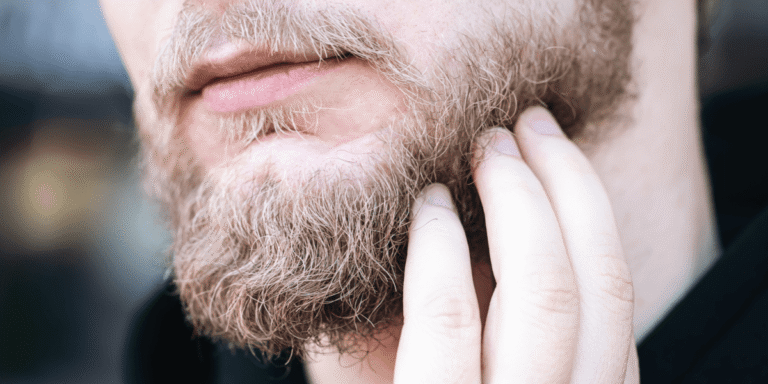 Sores Under The Beard: Causes