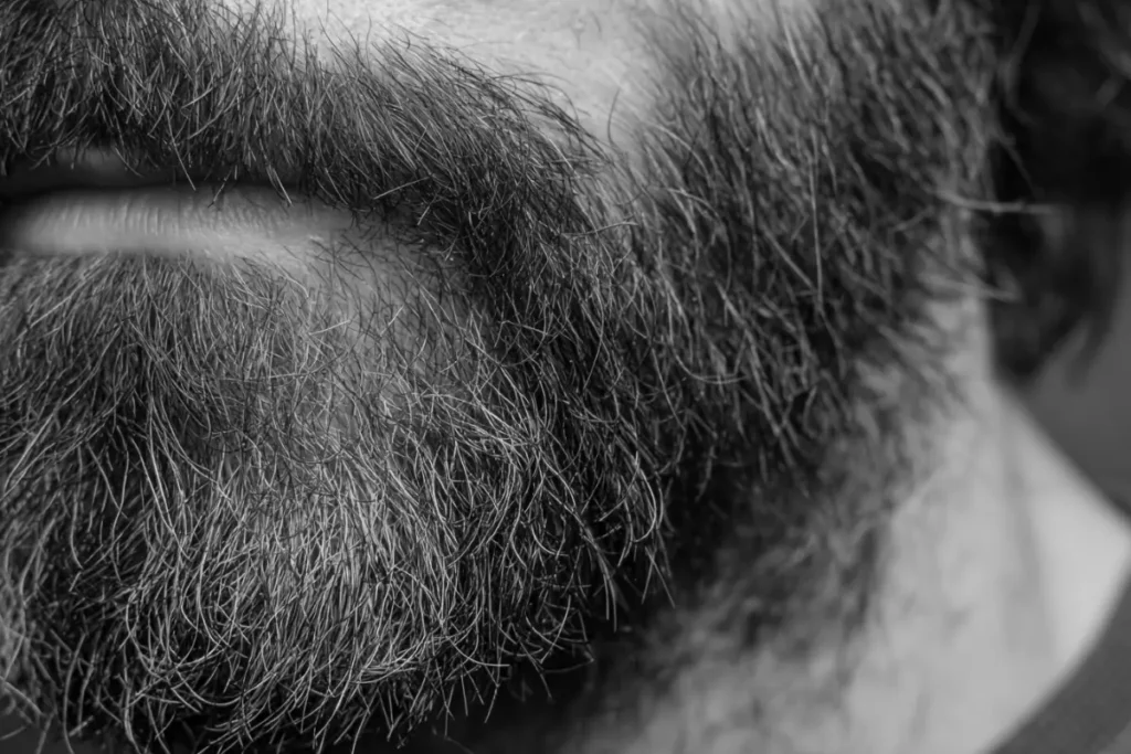 Close-up of rough beard hair with split ends and uneven texture, showing signs of beard breakage before the length can grow out.